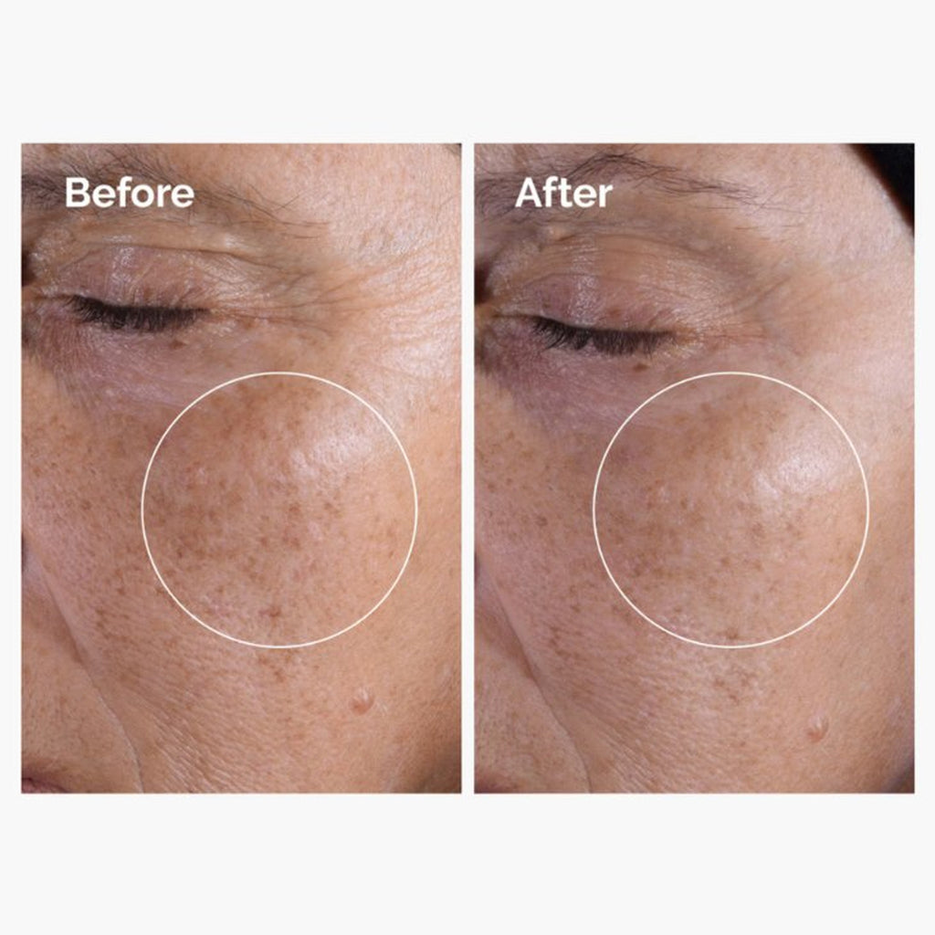 Glycolic Acid 7% Exfoliating Toner - The Ordinary