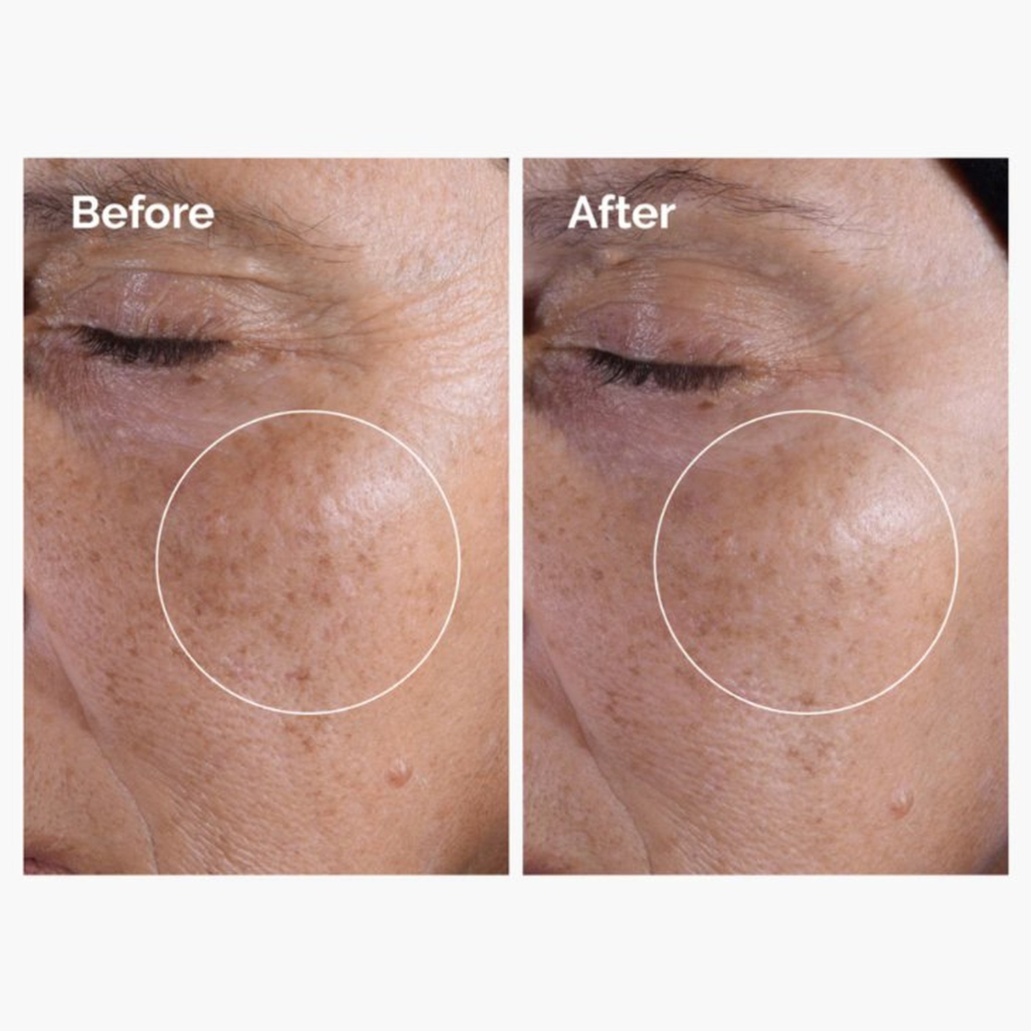 Glycolic Acid 7% Exfoliating Toner - The Ordinary